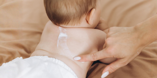 Why Does My Baby Get Dry Skin Even After Applying Lotion?